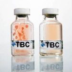 تست کیت SRB و TBC